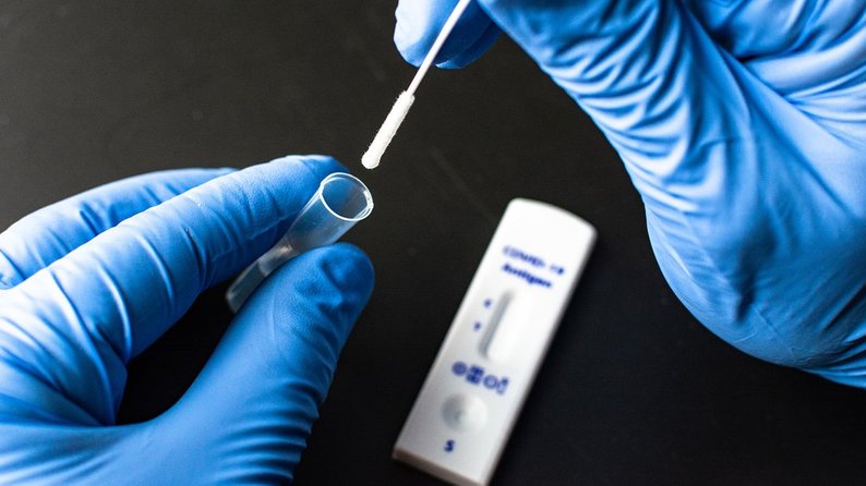 У Запорізькій області виявили перший випадок коронавірусу “Пірола”
