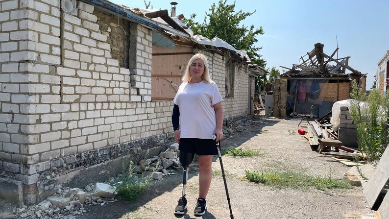 "Мені давали 4% на життя": історія жительки Зарічного на Запоріжжі, яка пережила ампутацію внаслідок обстрілу РФ