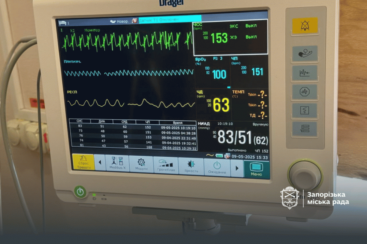 Як у запорізькій лікарні рятують немовлят - фото