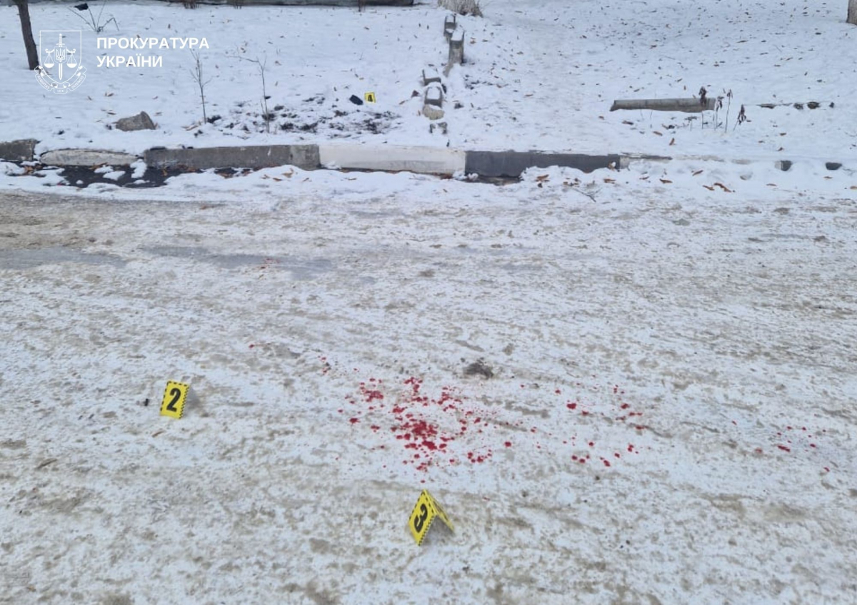 "Народився в сорочці" - підліток із Запоріжжя вижив після пострілу в голову