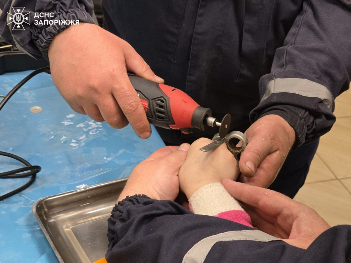 Забавка обернулась неприємностями: у Запоріжжі рятувальники прийшли на допомогу дитині (фото)